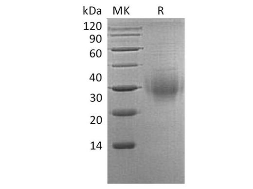 Recombinant Human BTLA/CD272 Protein (His Tag) - ABMIUM