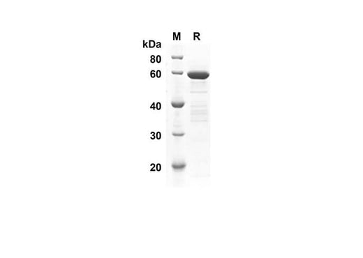 SDS-PAGE analysis of Human MAPK3 proteins, 2 μg/lane of Recombinant Human MAPK3 proteins was resolved with SDS-PAGE under reducing conditions, showing bands at 54.5 kDa.