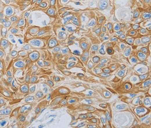 Anti-Human MC5R Antibody