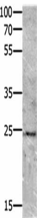 Western blot analysis of Mouse brain tissue using VEGFB Polyclonal Antibody at dilution of 1:700