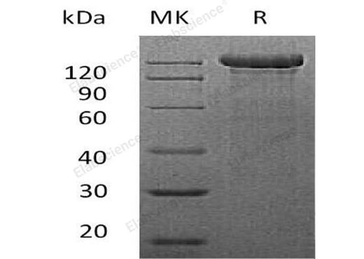 Recombinant Mouse Semaphorin-4C/SEMA4C Protein (Fc Tag) - ABMIUM
