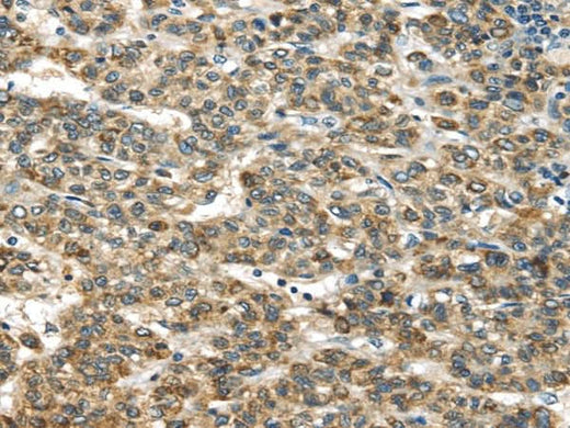 Anti-Human TNFAIP2 Antibody - ABMIUM