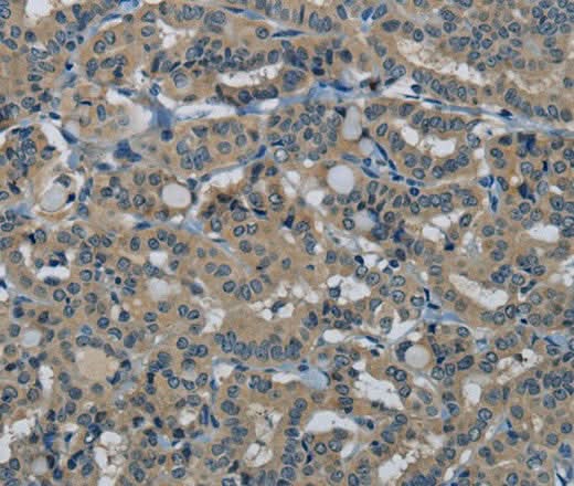 Anti-Human/Mouse HSPG2 Antibody - ABMIUM