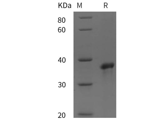 SDS-PAGE analysis of Human SNAI2 proteins, 2 μg/lane of Recombinant Human SNAI2 proteins was resolved with SDS-PAGE under reducing conditions, showing bands at 38 kDa.