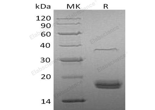 Recombinant Human VEGF-D/VEGFD Protein (His Tag) - ABMIUM