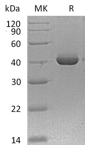 Recombinant Mouse TNFRSF13B/TACI/CD267 Protein (Fc Tag) - ABMIUM