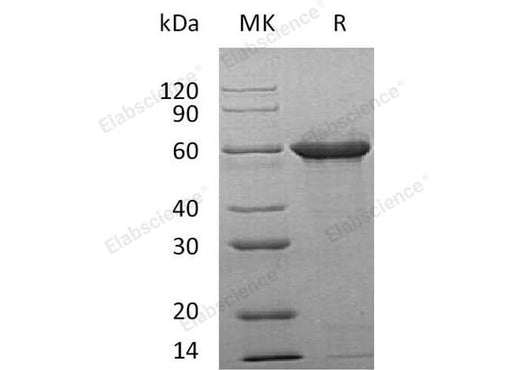 Recombinant Human Tau-F Protein - ABMIUM