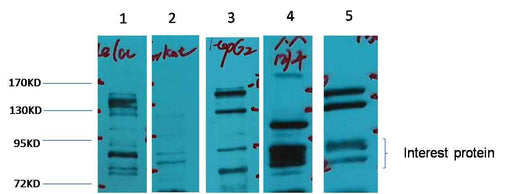 Glucocorticoid receptor Rabbit pAb