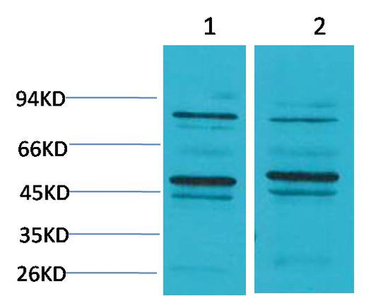 Bestrophin-2 Rabbit pAb 50µL/100µL