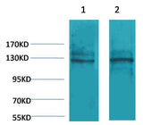 Calcium Sensing Receptor Rabbit pAb
