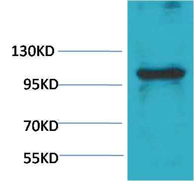 eEF1A2 binding protein Rabbit pAb