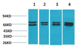 Estrogen Receptor α Rabbit pAb
