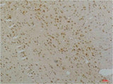 Cav1.2 Rabbit pAb
