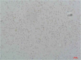 Cav3.2 Rabbit pAb