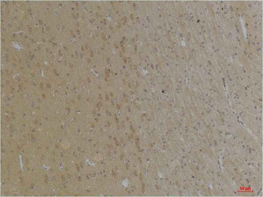 KCNK4(TRAAK) Rabbit pAb