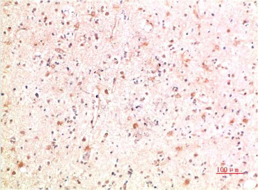 PI3 Kinase P85 Rabbit pAb