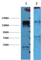 ErbB-2/HER-2 Mouse mAb
