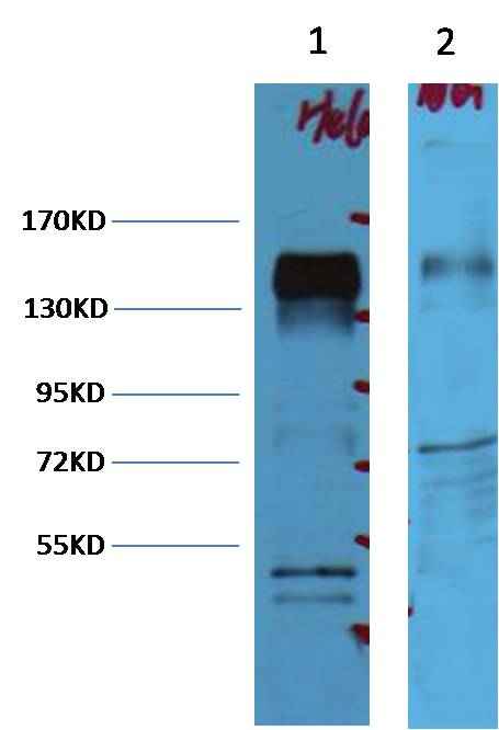 ErbB-2/HER-2 Mouse mAb