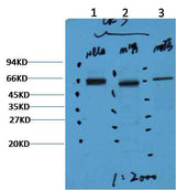 CK7 Mouse mAb
