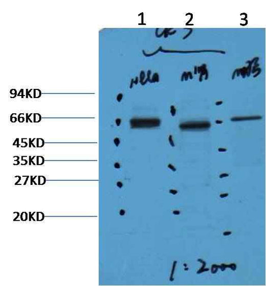 CK7 Mouse mAb