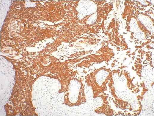 CK16 Mouse mAb