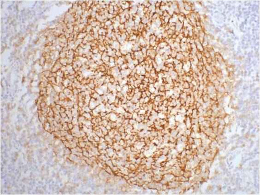 CD21 Mouse mAb