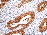 Carcinoembryonic Antigen/CEA Mouse mAb 50µL/100µL