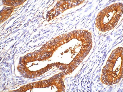 Carcinoembryonic Antigen/CEA Mouse mAb 50µL/100µL