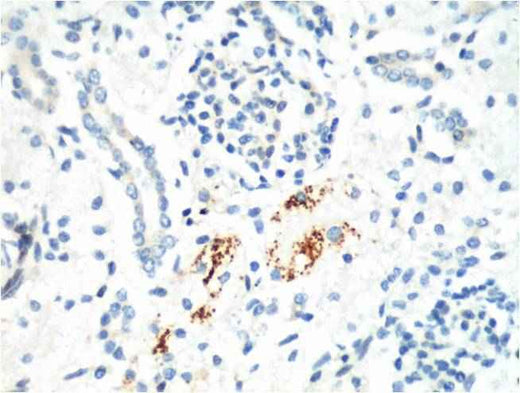Kif 7 Mouse mAb