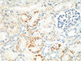 Ki 67 Mouse mAb