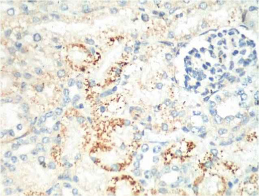 Ki 67 Mouse mAb