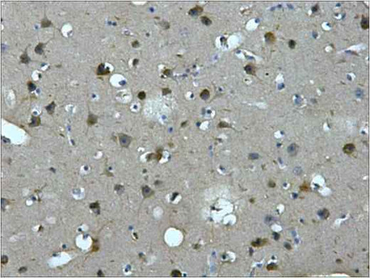 MAP2 Mouse mAb