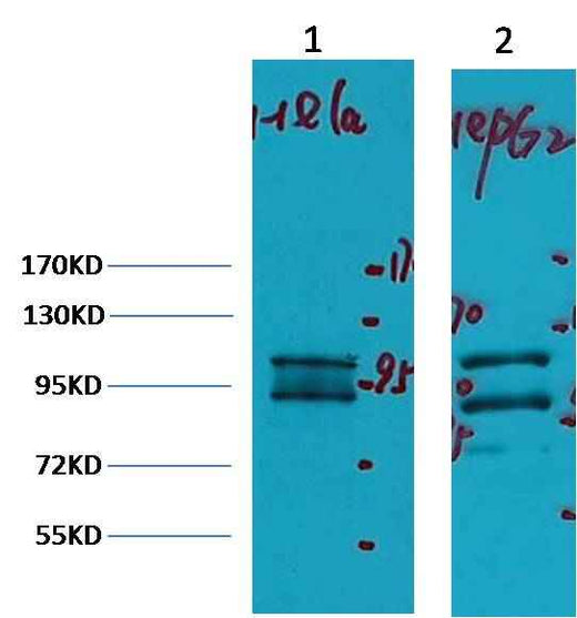 IDE/Insulin Degrading Enzyme Mouse mAb