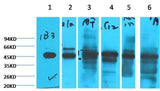 Cytokeratin 18 Mouse mAb