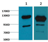 Cleaved PARP Mouse mAb