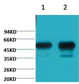 β II tubulin Mouse mAb