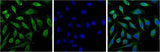 Progesterone Receptor Mouse mAb