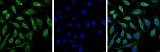 Progesterone Receptor Mouse mAb