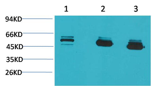 CBARA1/MICU1 Mouse mAb 50µL/100µL