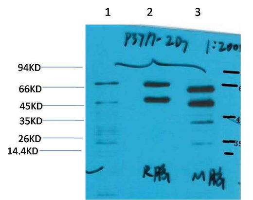 Phosphoserine Mouse mAb