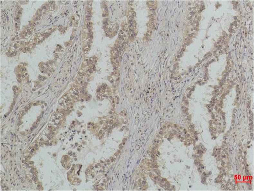 P53(Mono Methyl Lys370) Mouse mAb