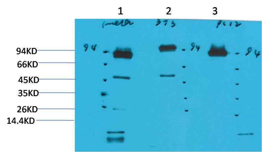 STAT3 Mouse mAb