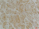 Desmin Mouse mAb