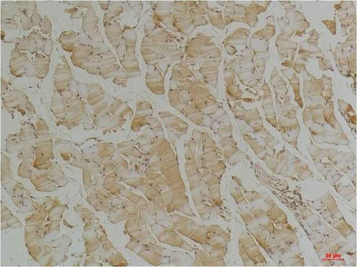 Desmin Mouse mAb