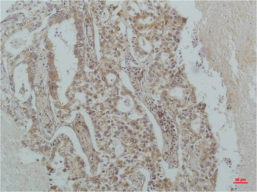 IκB β Mouse mAb 50µL/100µL