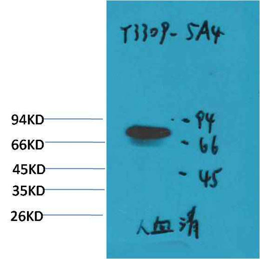 Transferrin Mouse mAb