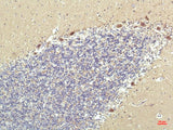 PPAR Delta (2F9) Mouse mAb 50µL/100µL