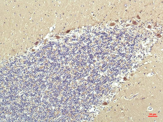 PPAR Delta (2F9) Mouse mAb 50µL/100µL