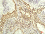 P70 S6 Kinase (1C7) Mouse mAb