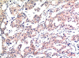 Acetyl-Histone H3 (K9) (2E7) Mouse mAb